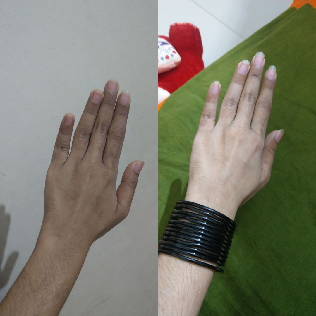 Before After Result